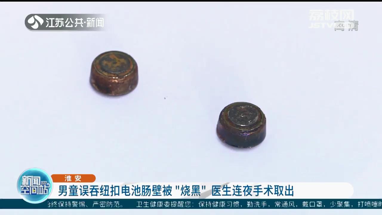淮安一男童误吞纽扣电池肠壁被&ldquo;烧黑&rdquo;医生连夜手术取出