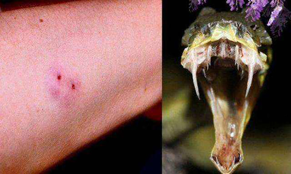 农村常见的八大伤人毒蛇,分别是谁?它们毒液的毒性,又如何呢?