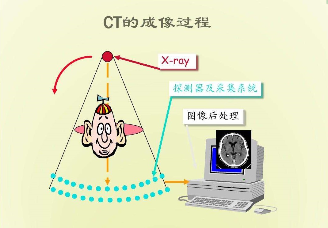 腰背疼，上医院就得先拍片？不做检查就不会看病了？医生说出实情