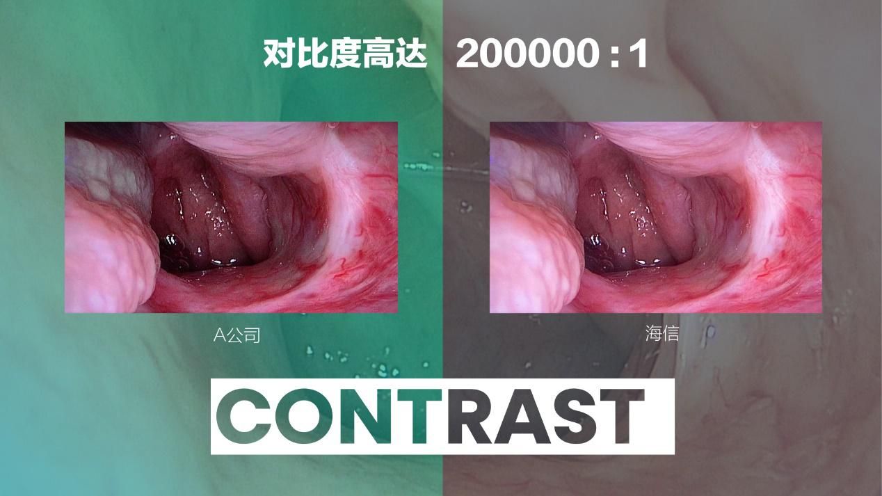 海信發(fā)布全球首臺55吋Mini-LED醫(yī)用內窺顯示器