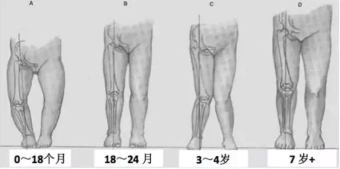 给新生儿绑腿的原因或许老人想错了，怎样让宝宝腿型漂亮，要记牢