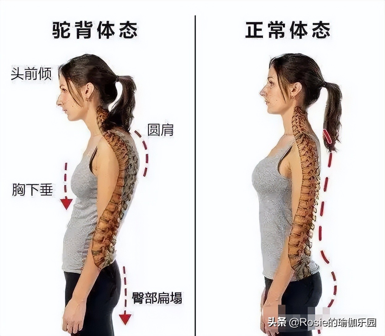 赵丽颖官宣美出新高度，体重不过百还是胖？四个体态问题要关注