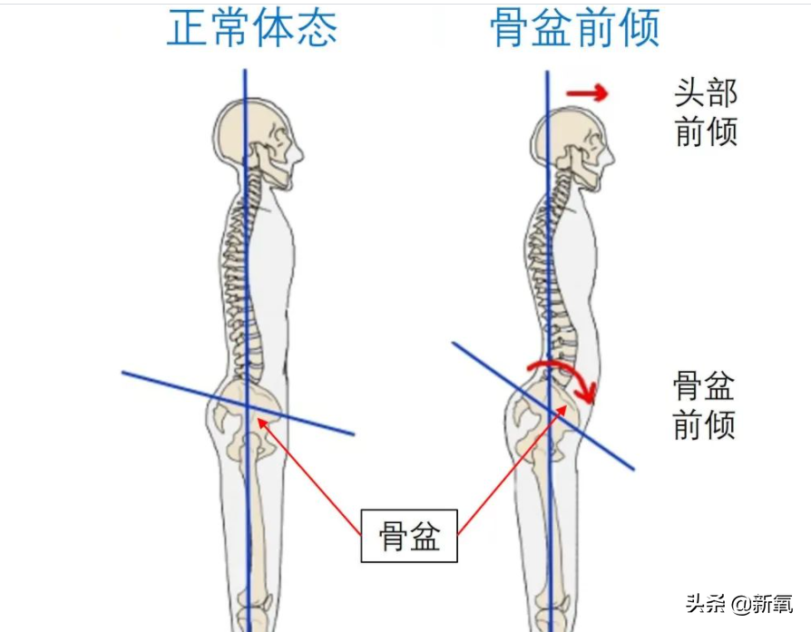 新剧一出场小腹凸成一坨？这翻车的体态硬是被腿精天花板当场救回