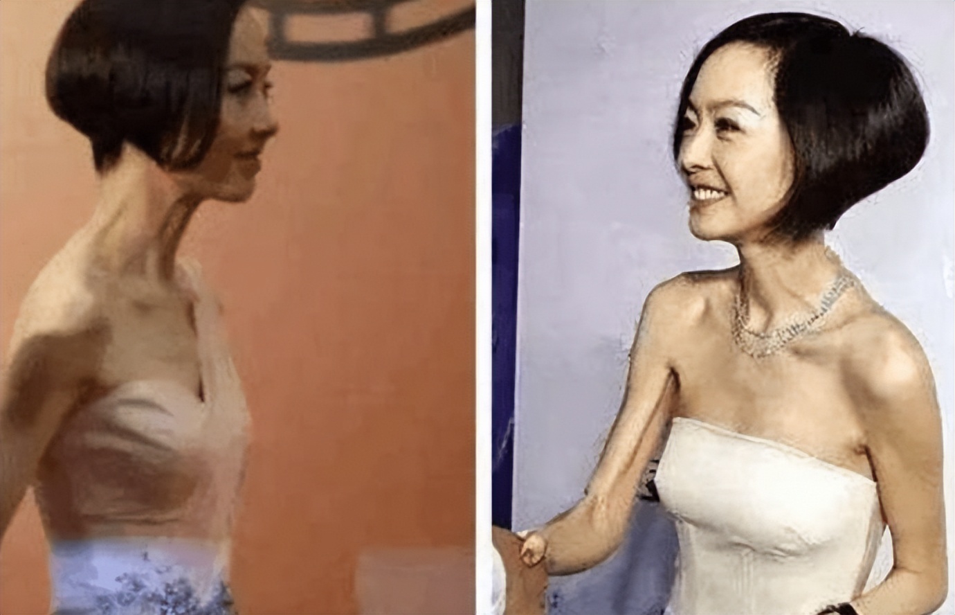 越瘦越丑的10位女星，个个皮松肉垮，脸无二两肉