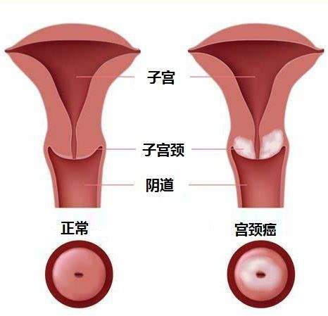 男性生殖器有白色污垢图片(丁丁冒出白色液体) - 赤虎壹号