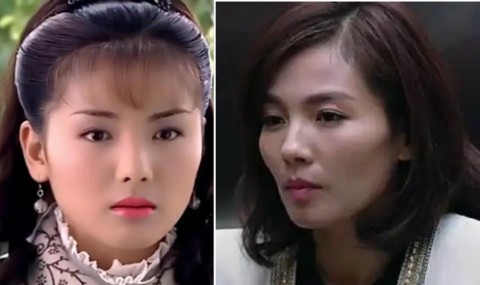 别再说高颧骨、方下颌抗老了！真正耐老的脸，得具备这3个条件