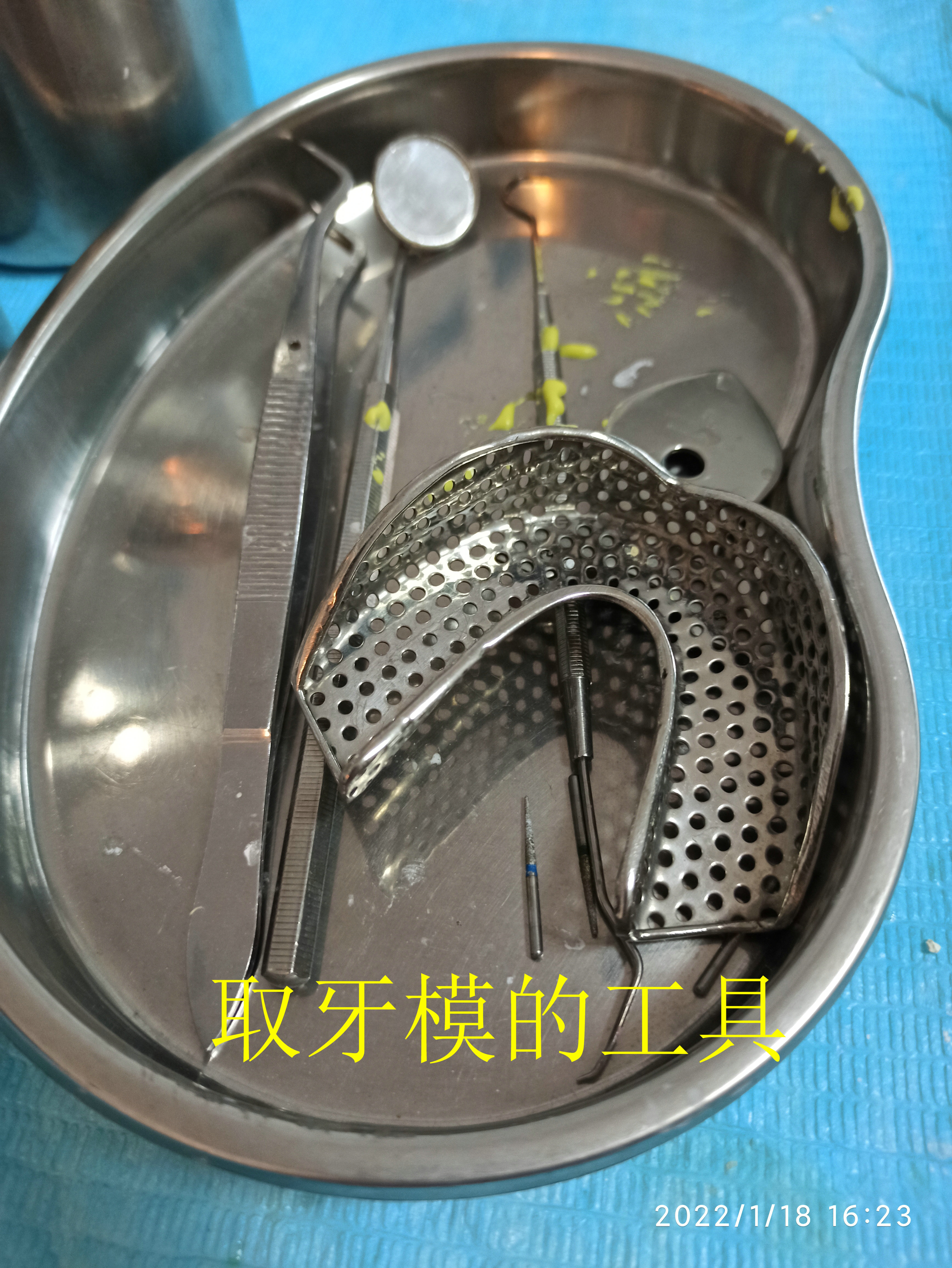32岁拔了10颗牙，还花8500去镶假牙，我这是遭的哪门子罪呀
