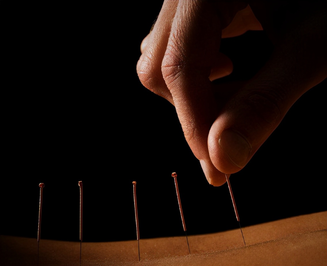 古代针灸用具是什么(中国古代针法有多神?