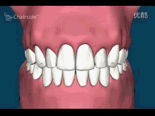 牙齿经常上火、牙龈发炎的人注意了！你们可能已被心血管疾病盯上