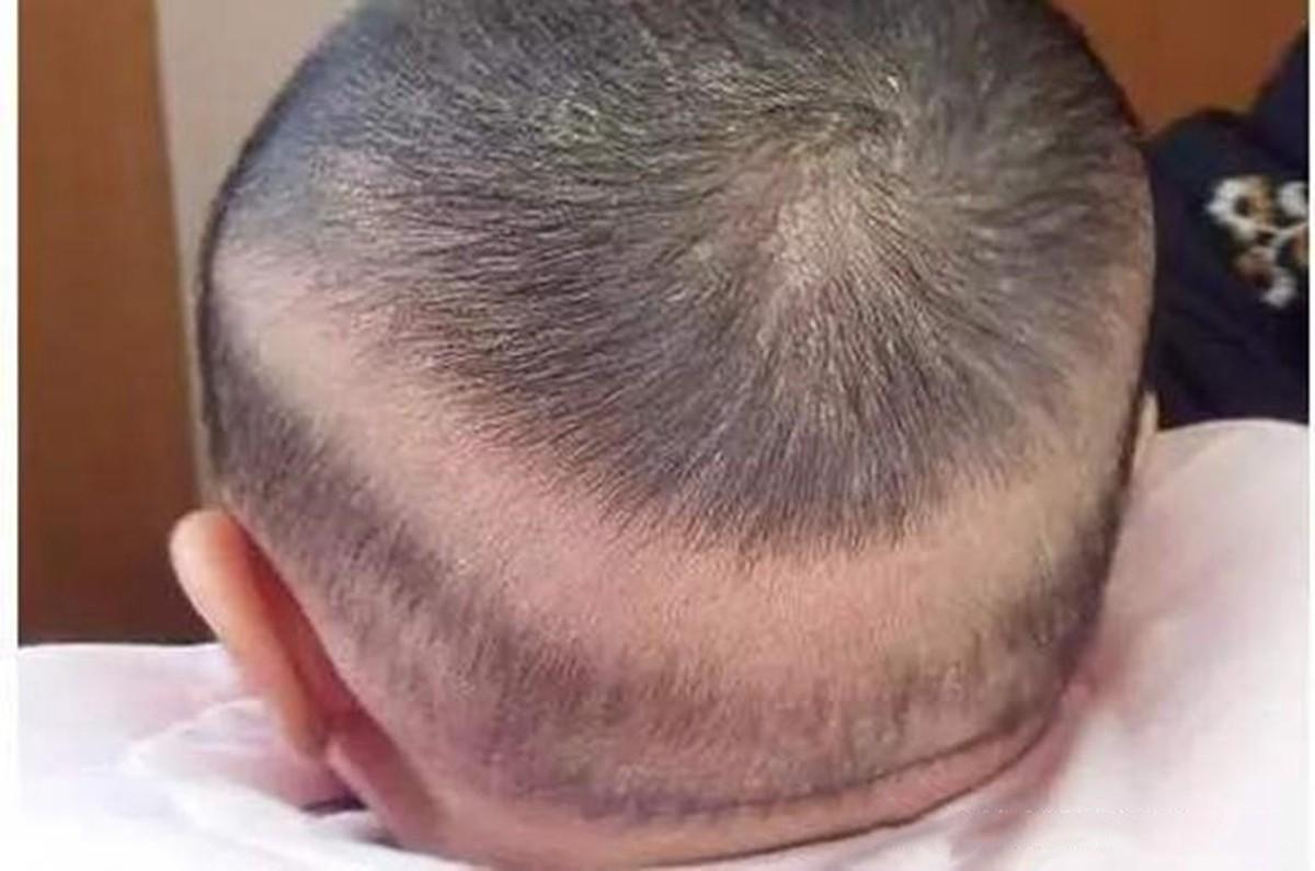 宝宝出现"枕秃"是缺钙?谣言是时候该被揭穿了,真相你要弄清楚