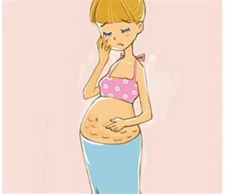 妊辰纹成为不少宝妈的困扰，那么，如何预防孕期长妊辰纹？