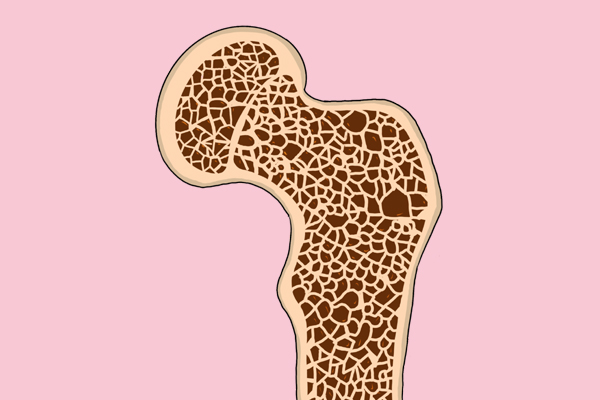 骨密度下降，会带来哪些问题？怎么做能够强化骨头？