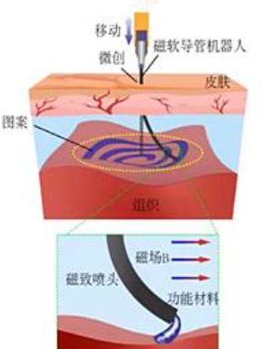 磁控软体机器人——生物医疗的福音