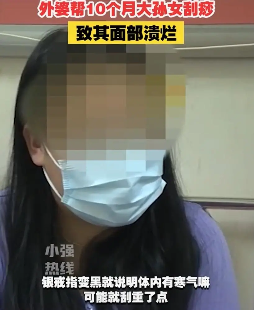 10个月女婴,被家人刮痧毁了脸