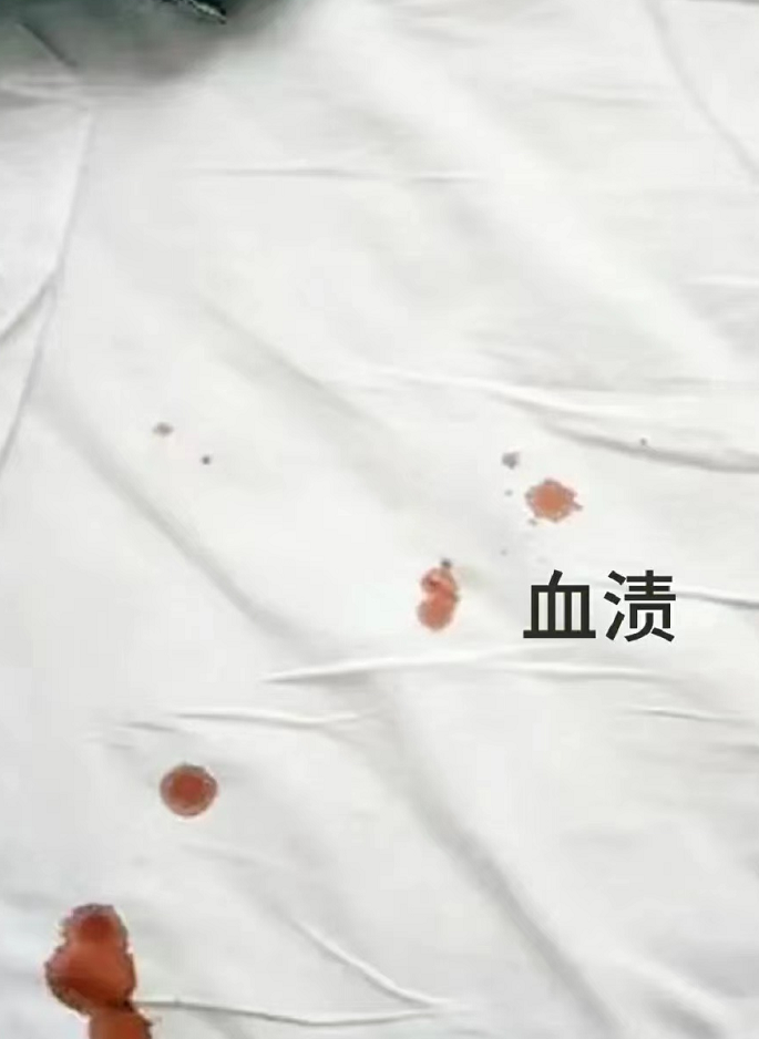 還在為衣服污漬煩惱嗎？教你一招輕松搞定