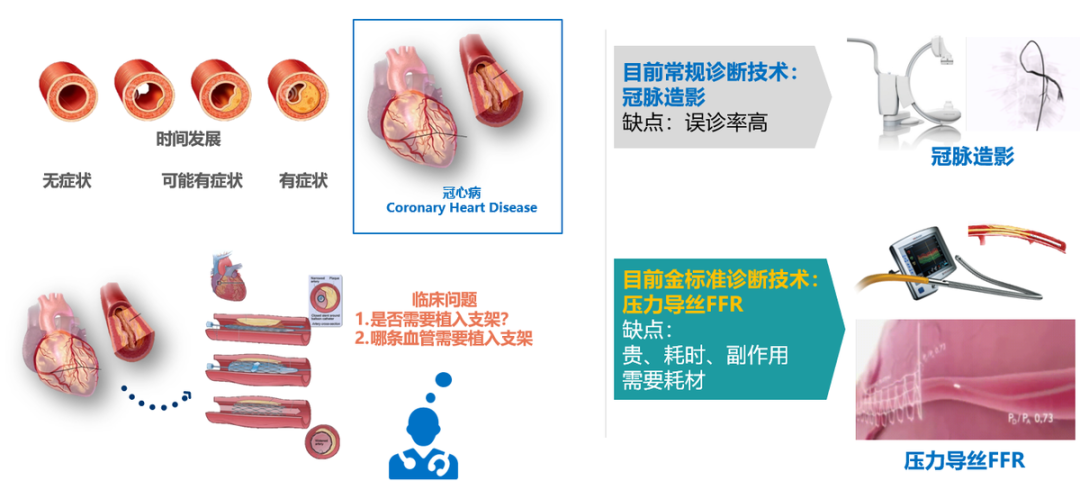 九個(gè)月虧2億！飛利浦、高瓴押注！影像FFR龍頭擬上市