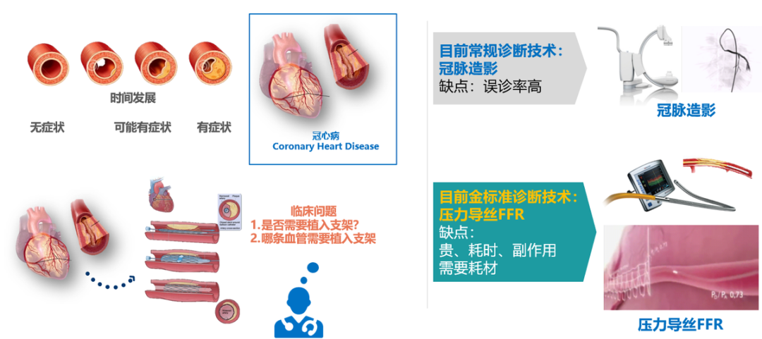 九个月亏2亿！飞利浦、高瓴押注！影像FFR龙头拟上市