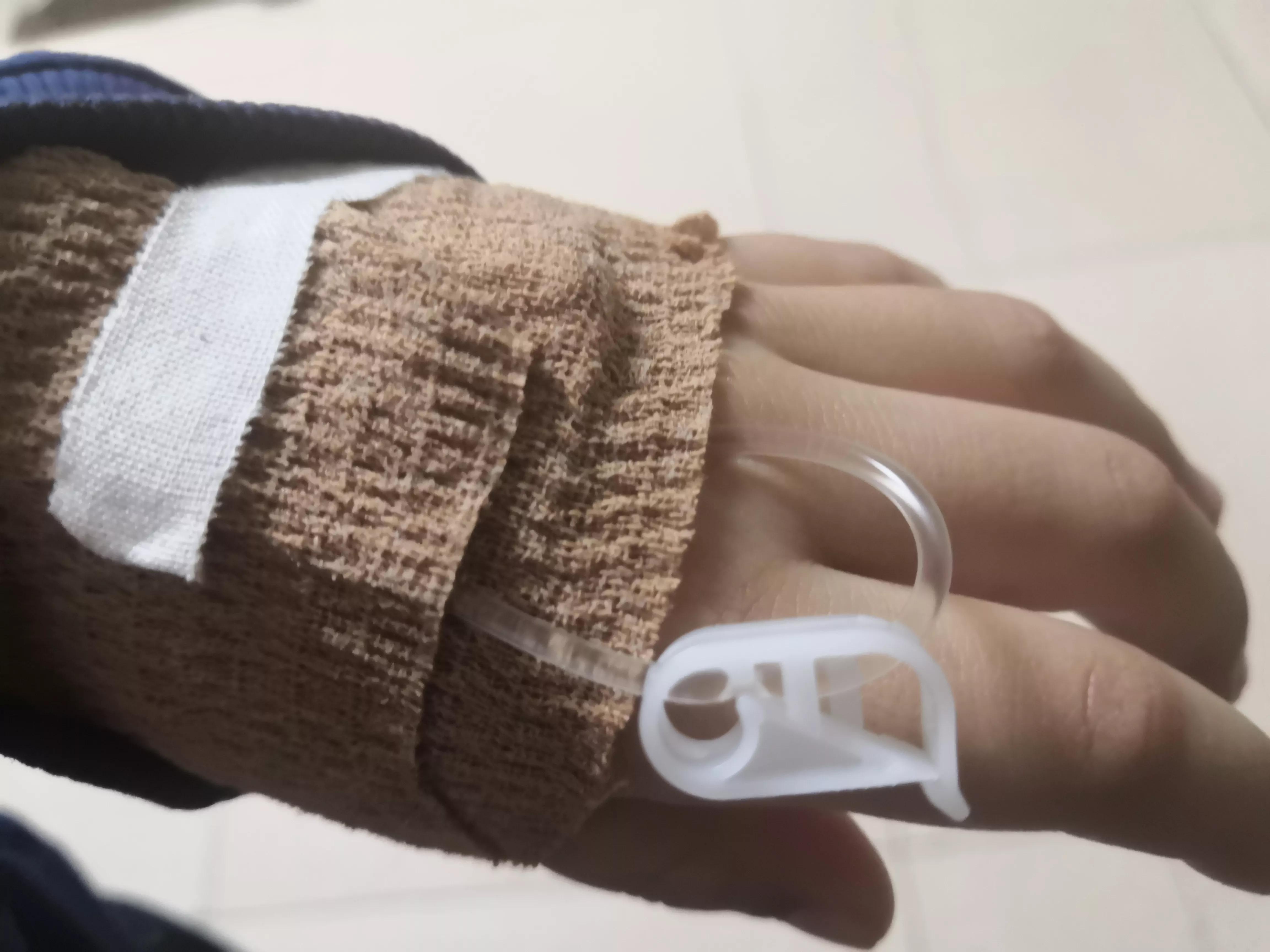 小旗回来的时候,手上带着留置针,他让我看他的手.