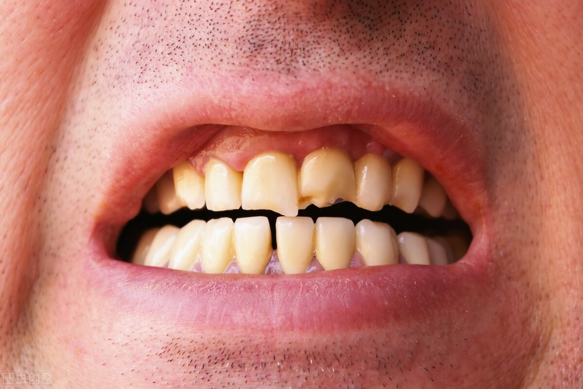 补牙后的牙齿一般能维持几年？