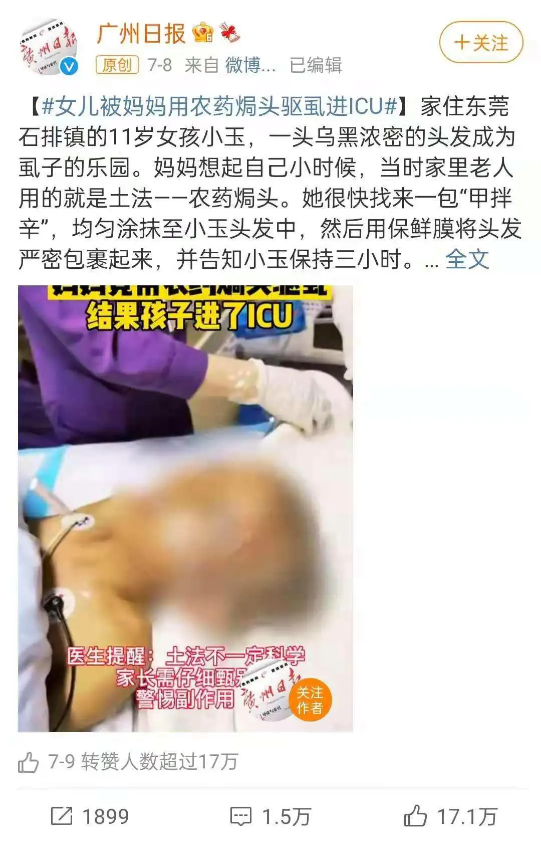 10个月女婴,被家人刮痧毁了脸