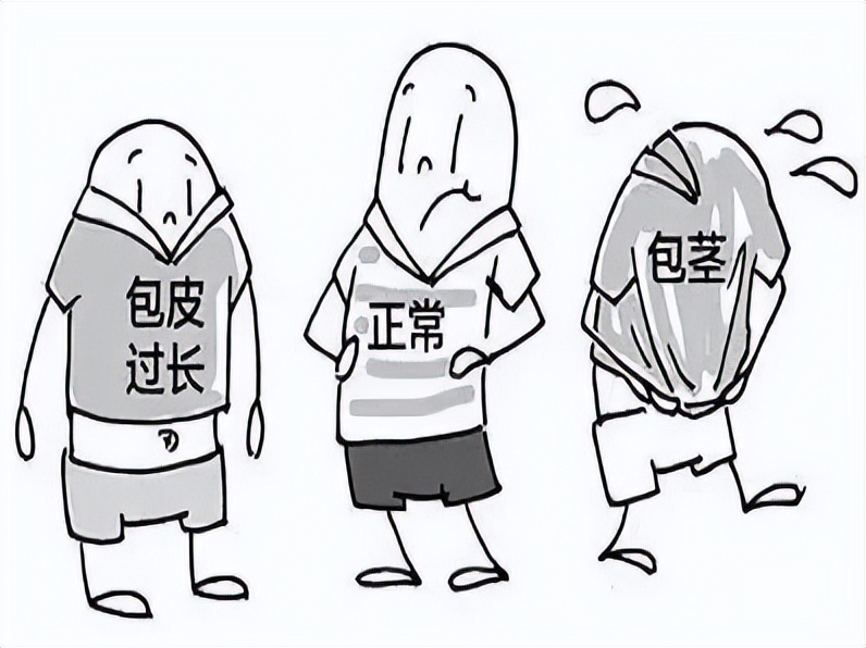 小男孩的包皮有三种状态:正常包皮,包皮过长,包茎二,什么情况下需要割