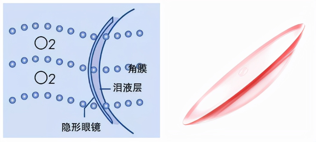 2000度近视，竟用一种硬的隐形眼镜收获逆袭人生？