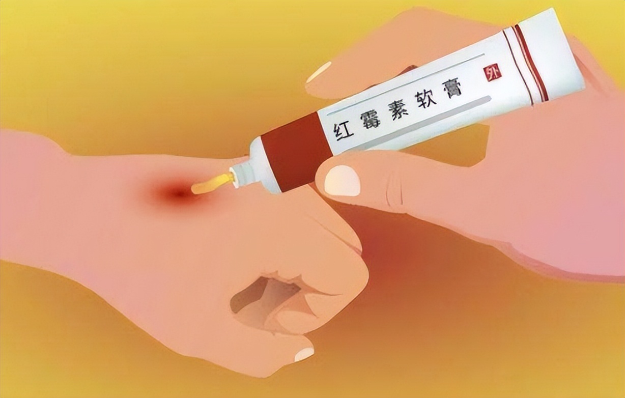 红霉素软膏，在眼部涂两下，对身体影响有多大？建议来了解下