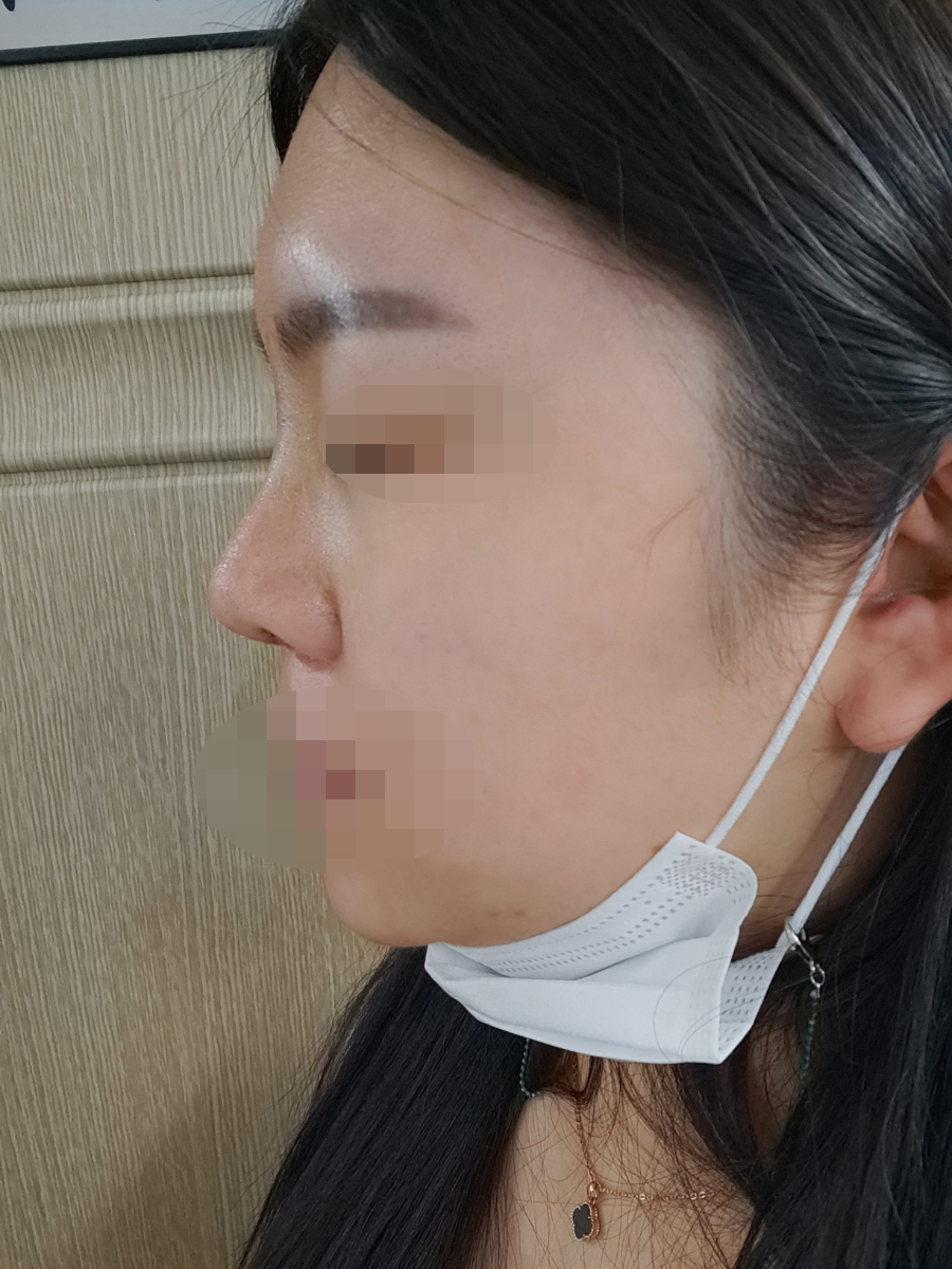 好看的鼻子真的能给你带来好运？38岁女士告诉你真实情况