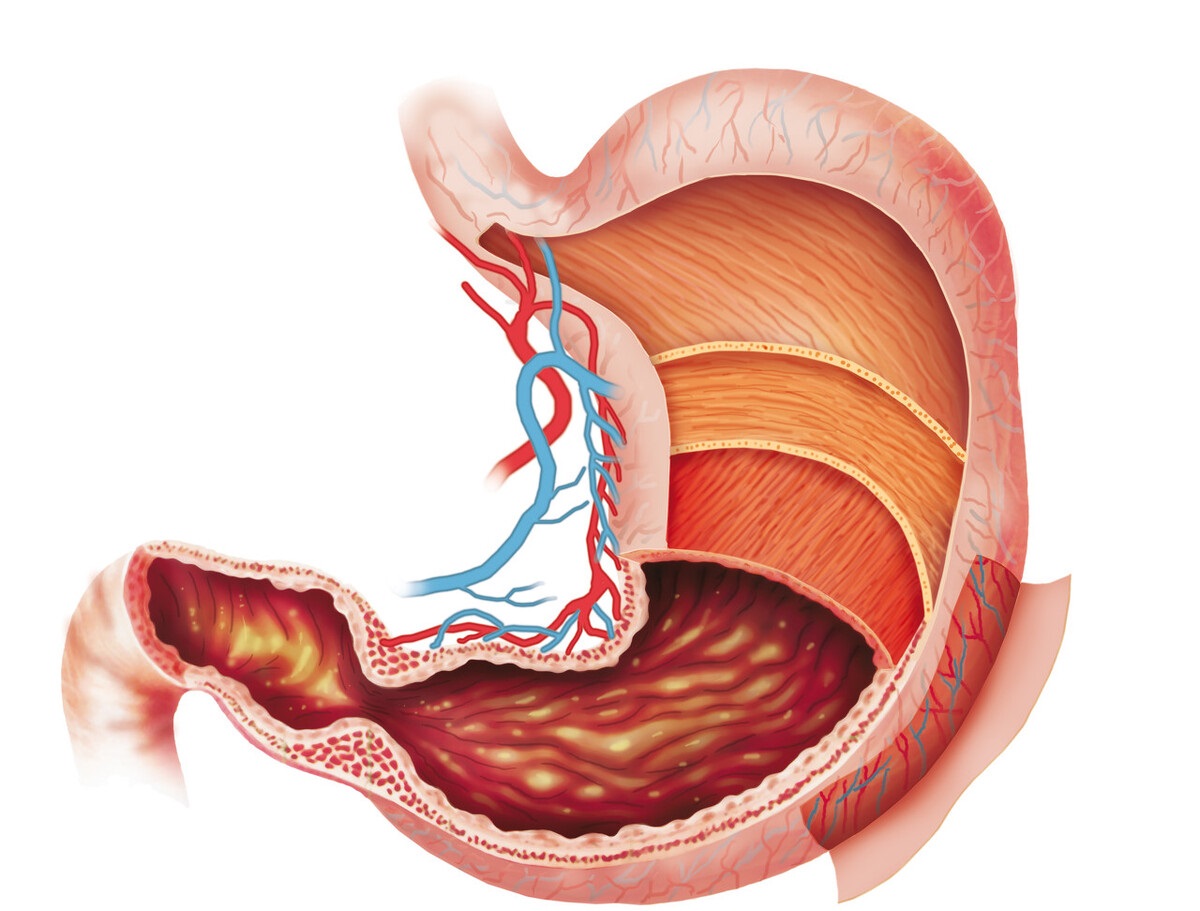 如何才能正确养胃