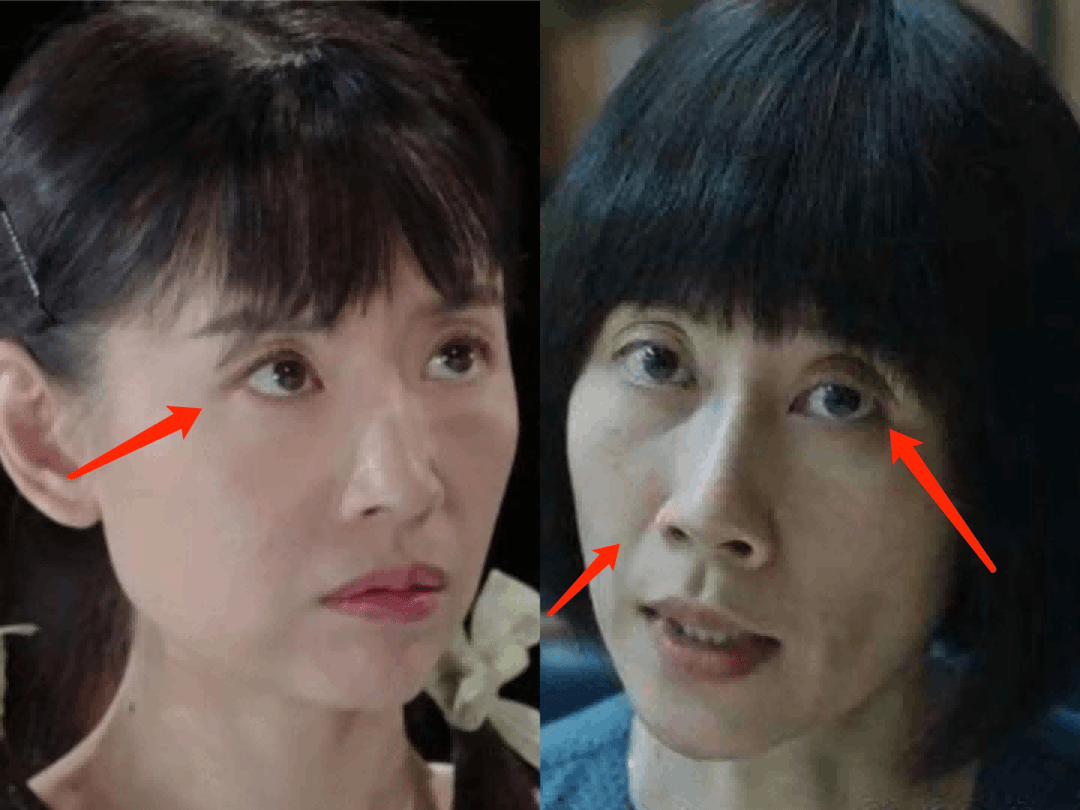 越瘦越丑的10位女星，个个皮松肉垮，脸无二两肉