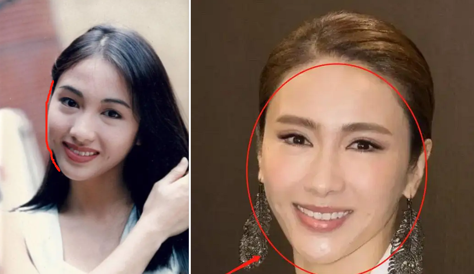 别再说高颧骨、方下颌抗老了！真正耐老的脸，得具备这3个条件