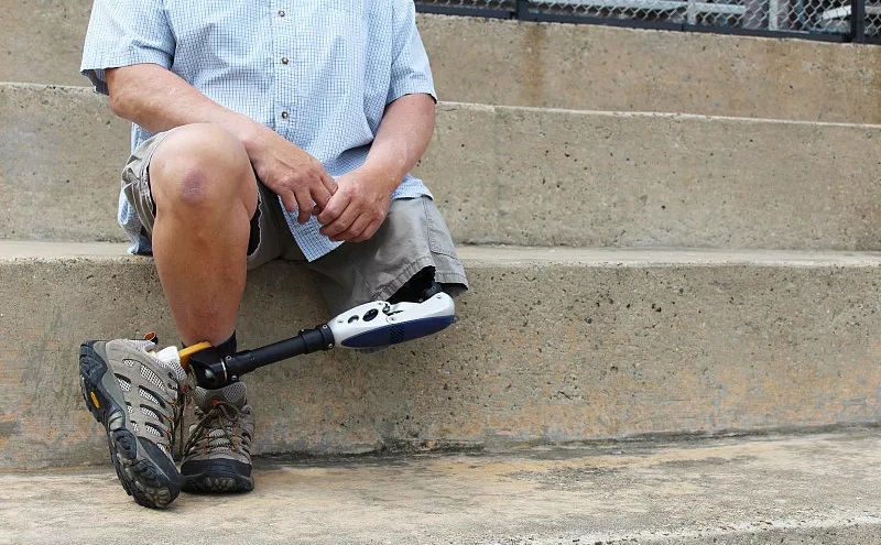 血糖高了，看脚就知道？脚部如果有这3种变化，提醒你该降糖了