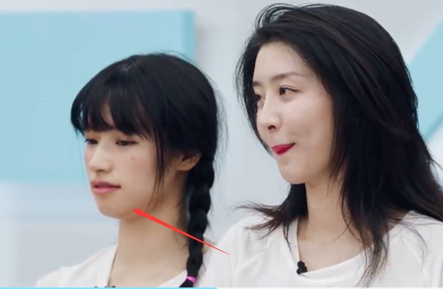 比“法令纹”更可怕的是“嘴凸”，显老苦相又土气，太多人遭殃了