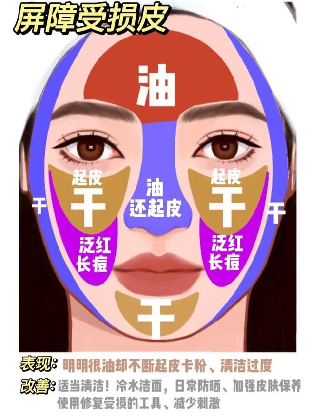 五种肤质区分图片,五种肤质区分图片男