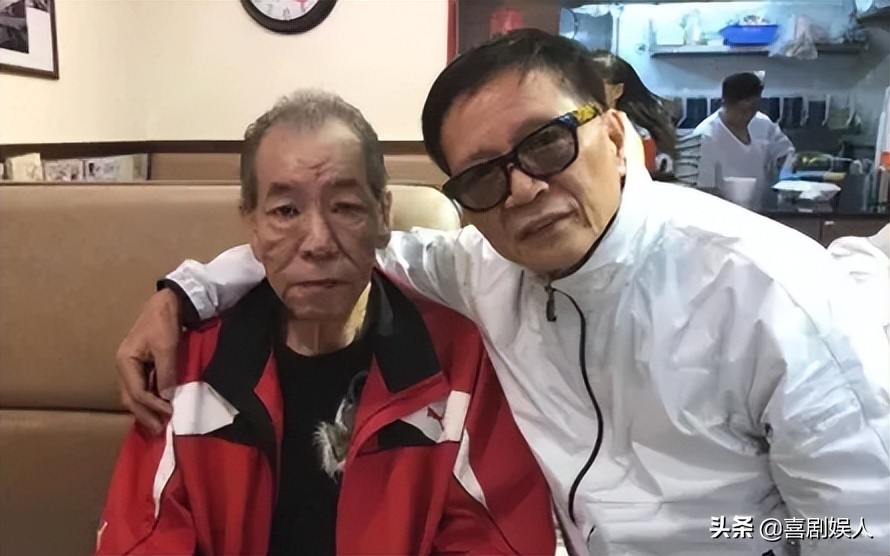 年轻时是人上人，晚年生活心酸，这9位巨星，最惨的靠洗肾续命