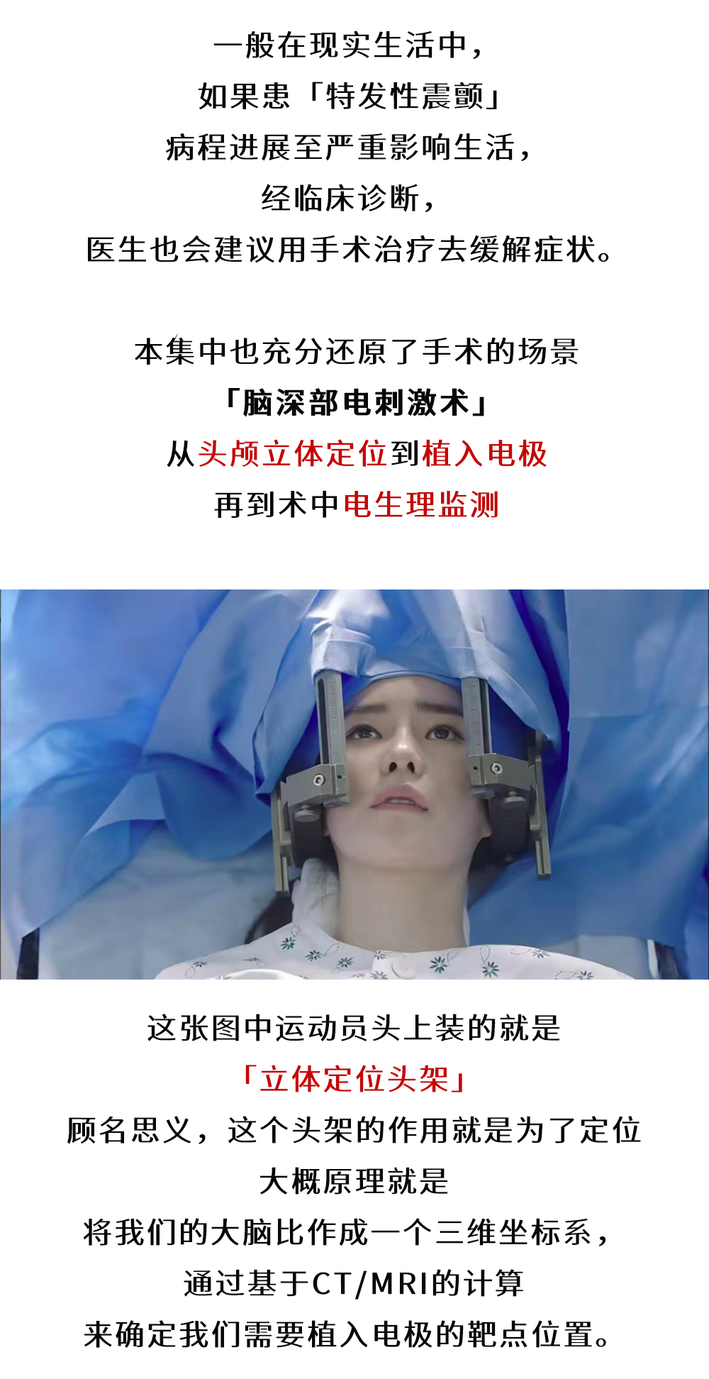 韩剧《Doctors》做起了脑起搏器手术，是天方夜谭还是有理有据？