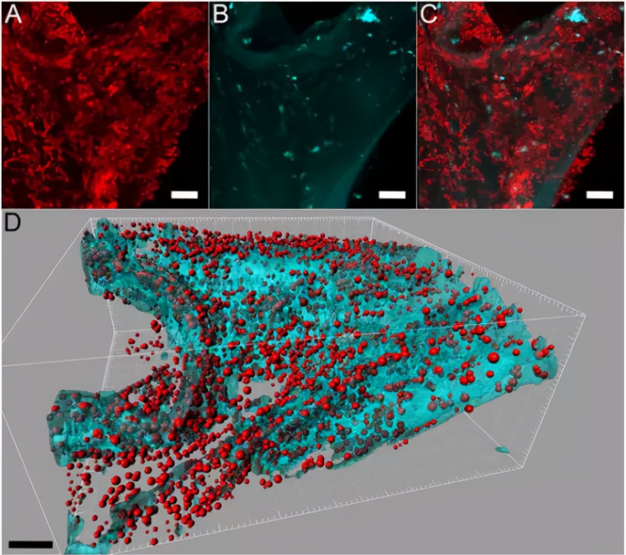 厨房海绵变细菌培养皿！1立方厘米500亿个细菌，比马桶还要脏