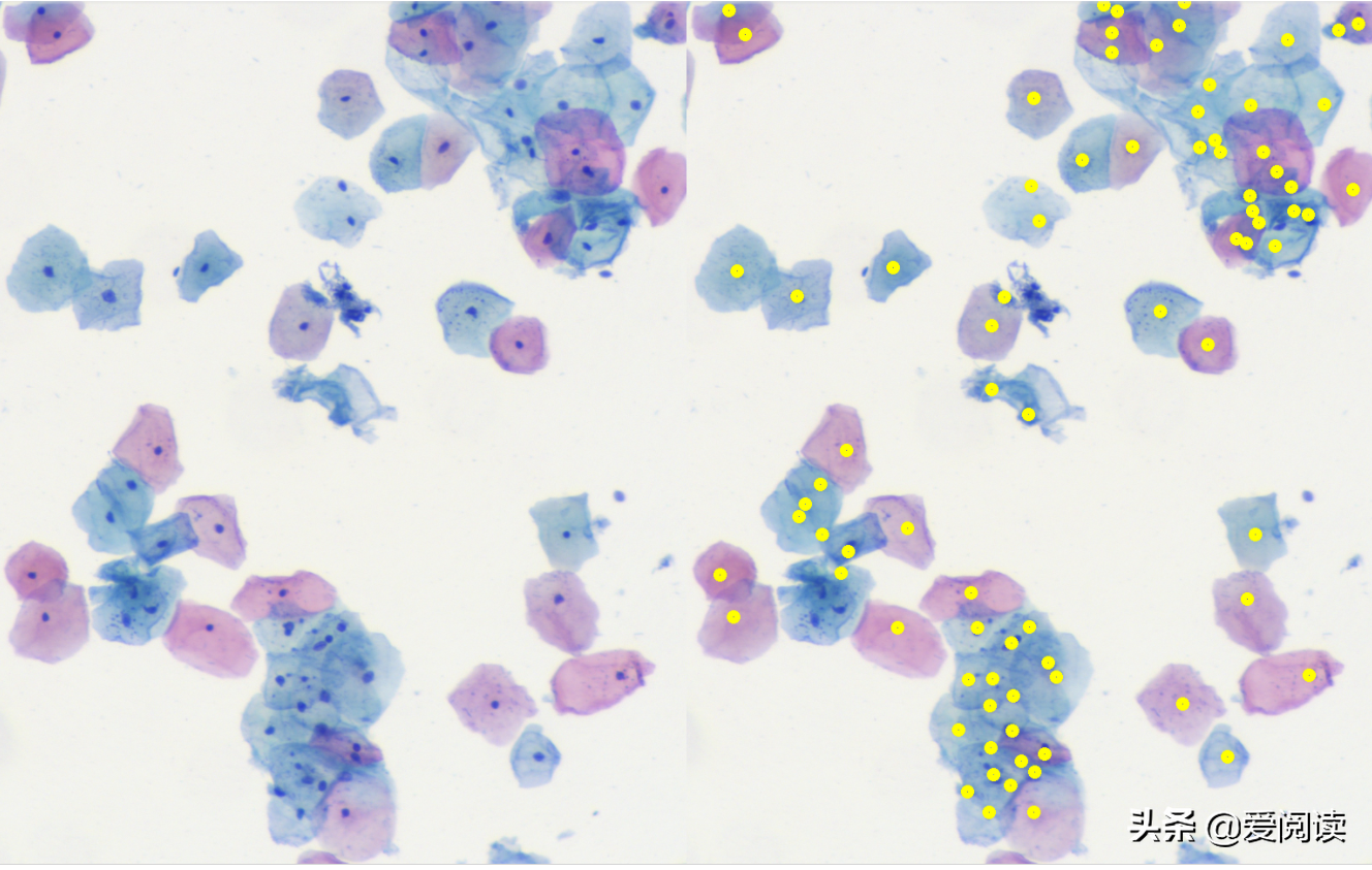 你试过吗？图像（细胞）分割