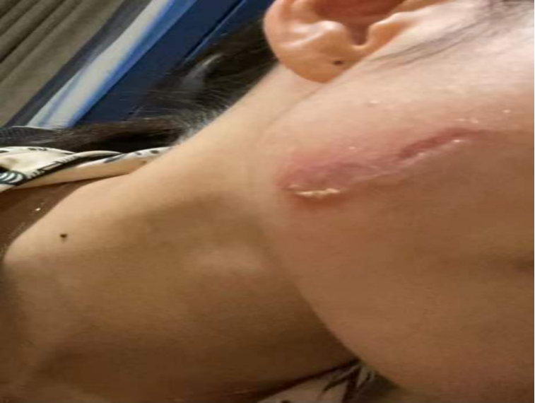 我眼中繁忙的泌尿外科