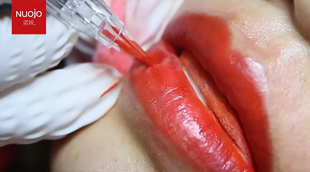 瘦唇针多少钱一针大鲨鱼三叉鱼尾针做机器点刺唇效果好吗