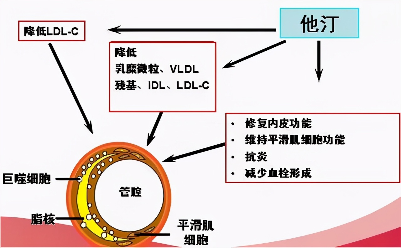 瑞舒伐他汀，进口的5元，国产0.2元，你还敢用吗？本文教你选