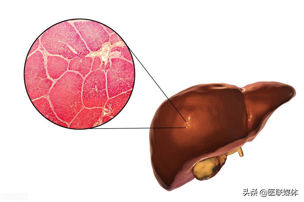 肝病患者为何越来越多？想预防，这2个好习惯希望能保持