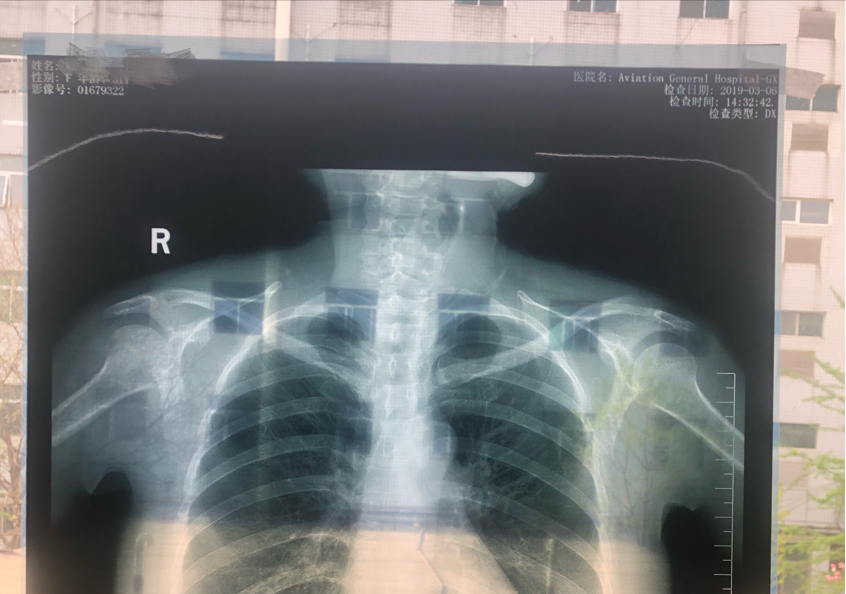 在家也能拍高清X线、CT、磁共振片？医生教你几招，在家轻松看病