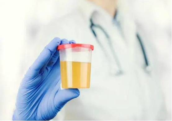 排尿很黄、异味很大？身体或是在向你暗示这5件事，别忽视了