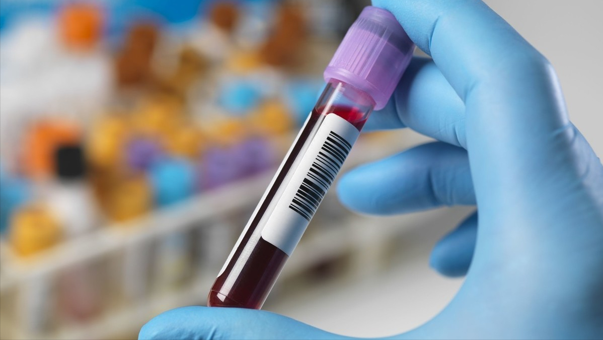 (cea),糖抗原ca199(ca199),糖抗原ca125(ca125),糖抗原ca153(ca153)