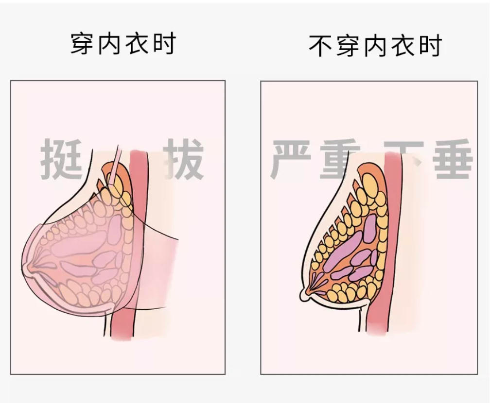 穿胸罩真的能防止乳房下垂吗？李冰冰，怎么就「穿着暴露」了？