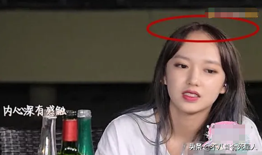 扁头，大头，秃头，这8位女星貌美如花，却“输”在了头上