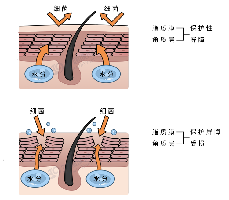 洗澡时身上搓出来的“泥”是脏东西吗？要搓干净吗？很多人做错了