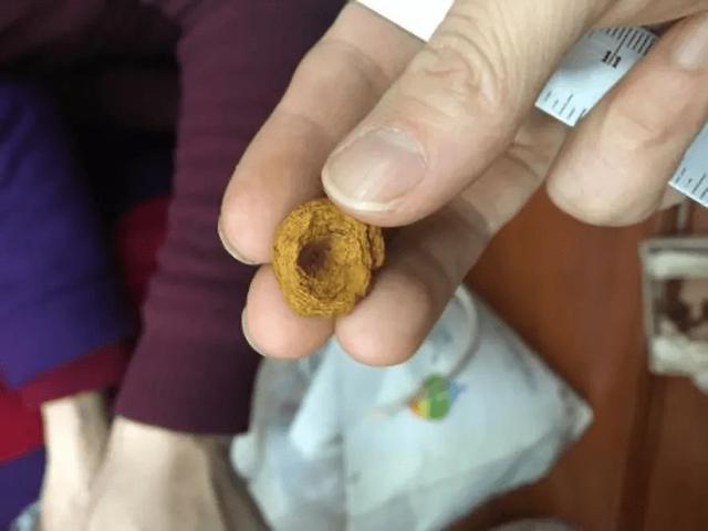 安宫牛黄丸一颗860？到底是真能治中风，还是徒有虚名？