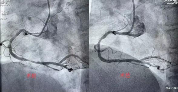 沈阳医学院附属第二医院：牛年岁尾，让胸痛患者安稳过除夕
